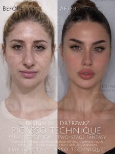 picasso technique gallery 2 1