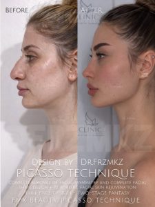 picasso technique gallery 2 2