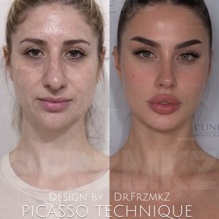 PTGallery picasso technique gallery 2 1