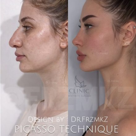 PTGallery picasso technique gallery 2 2